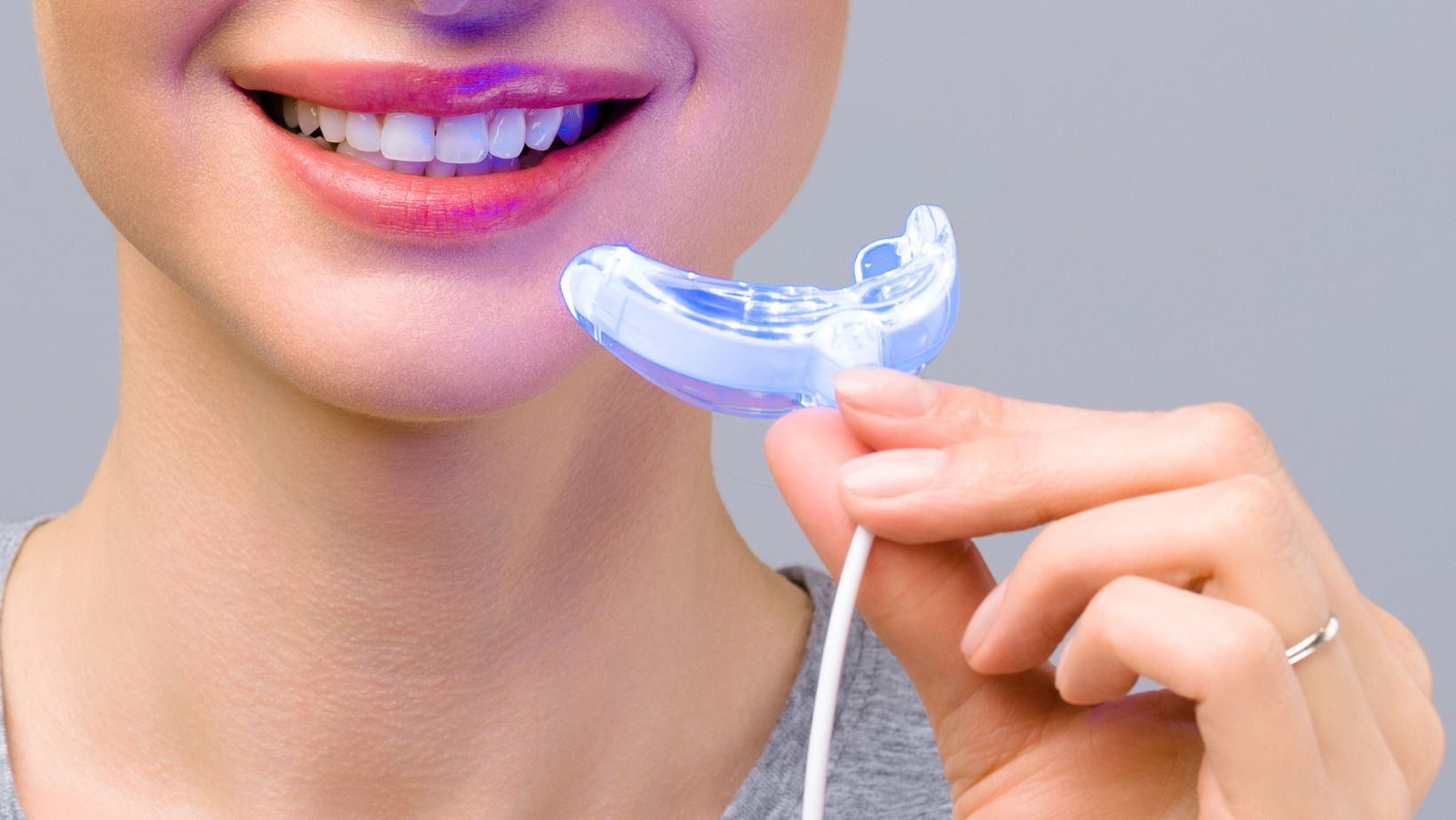 Onuge OEM Teeth Whitening Kits: Everything You Need To Know About
